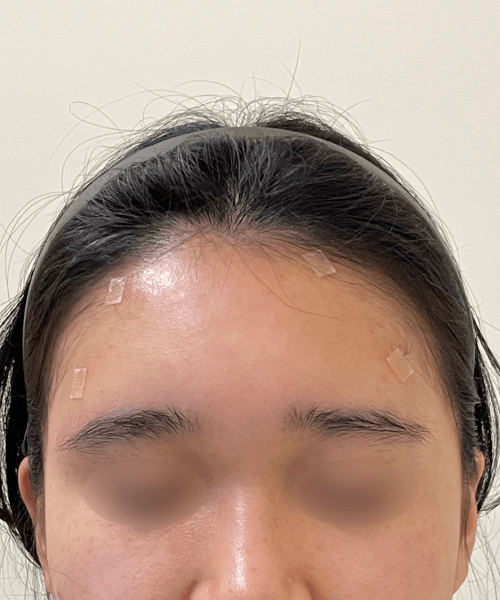 after